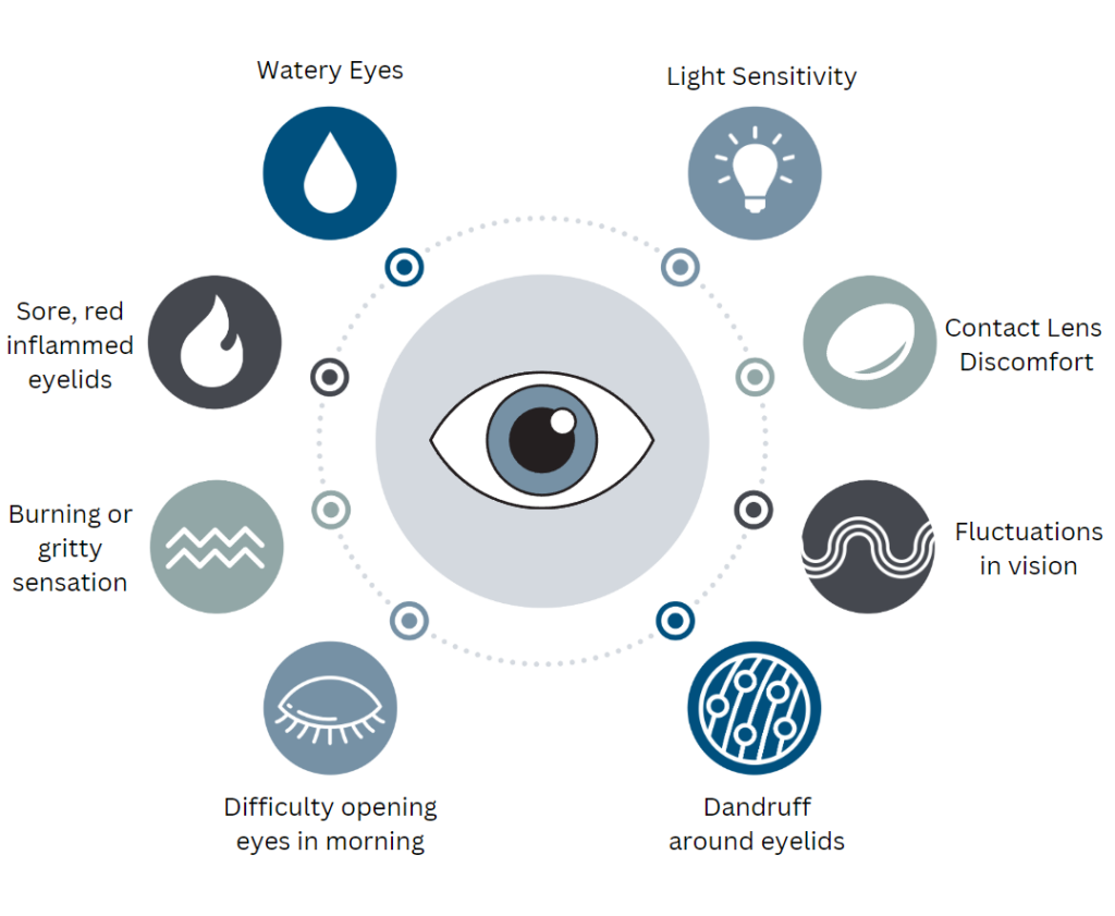 Dry Eye Symptoms Chart